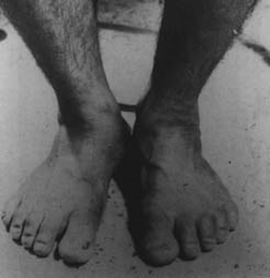 image-20250629205843542